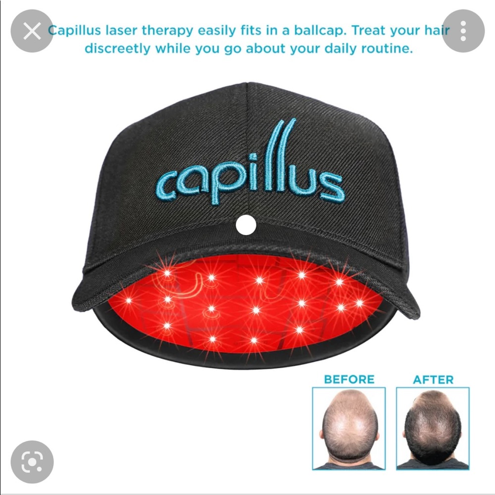 Capillus 82